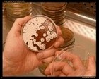Streptomyces on agar plate